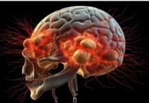 Roy Suryo: Mengapa Otak Fufufafa Harus Diperiksa Dengan Brain CT Scanner